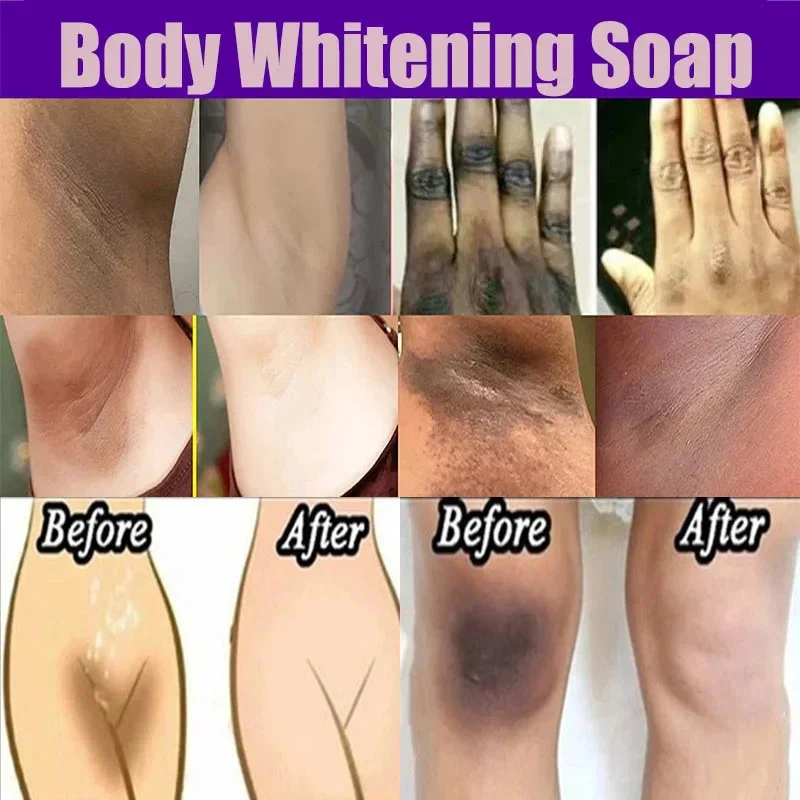 Body Whitening Soap Deep Clean Skin Chicken Skin Removal Soap Armpit Underarm Knees Bleaching Body Brighten White Care