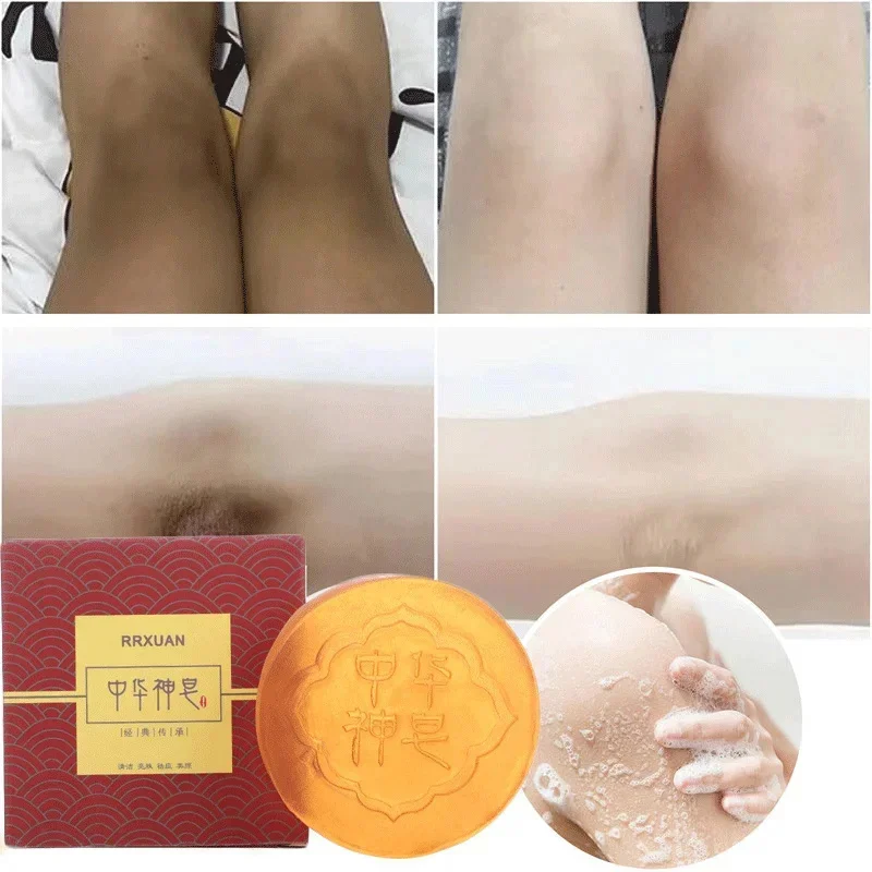 Body Whitening Soap Deep Clean Skin Chicken Skin Removal Soap Armpit Underarm Knees Bleaching Body Brighten White Care