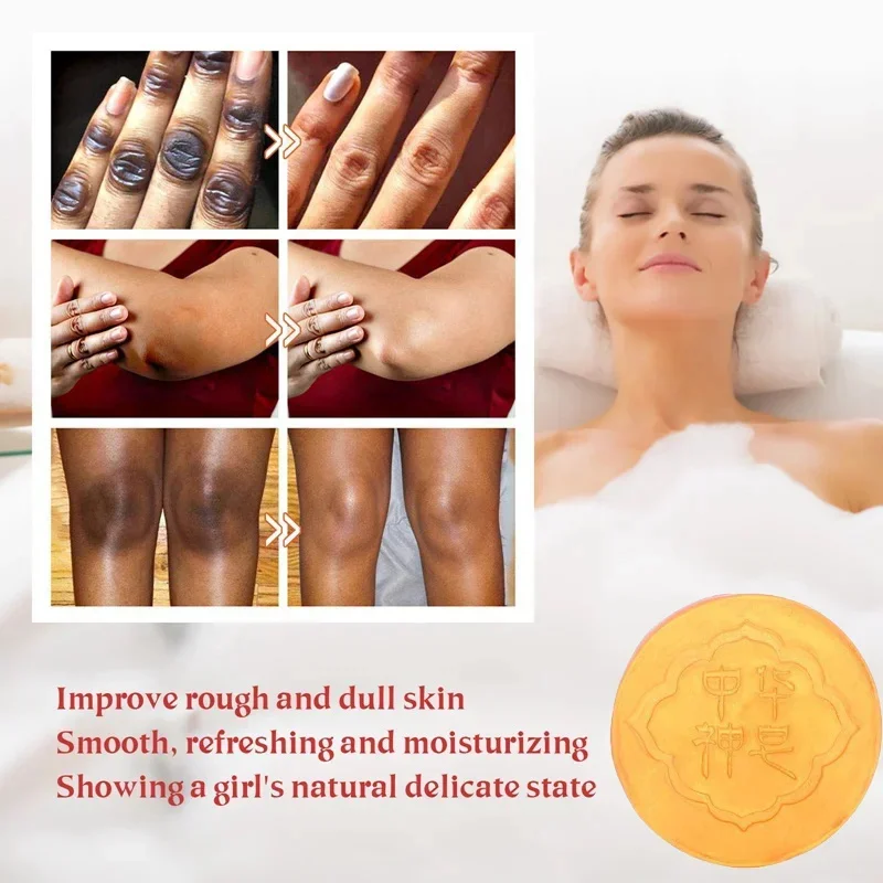 Body Whitening Soap Deep Clean Skin Chicken Skin Removal Soap Armpit Underarm Knees Bleaching Body Brighten White Care