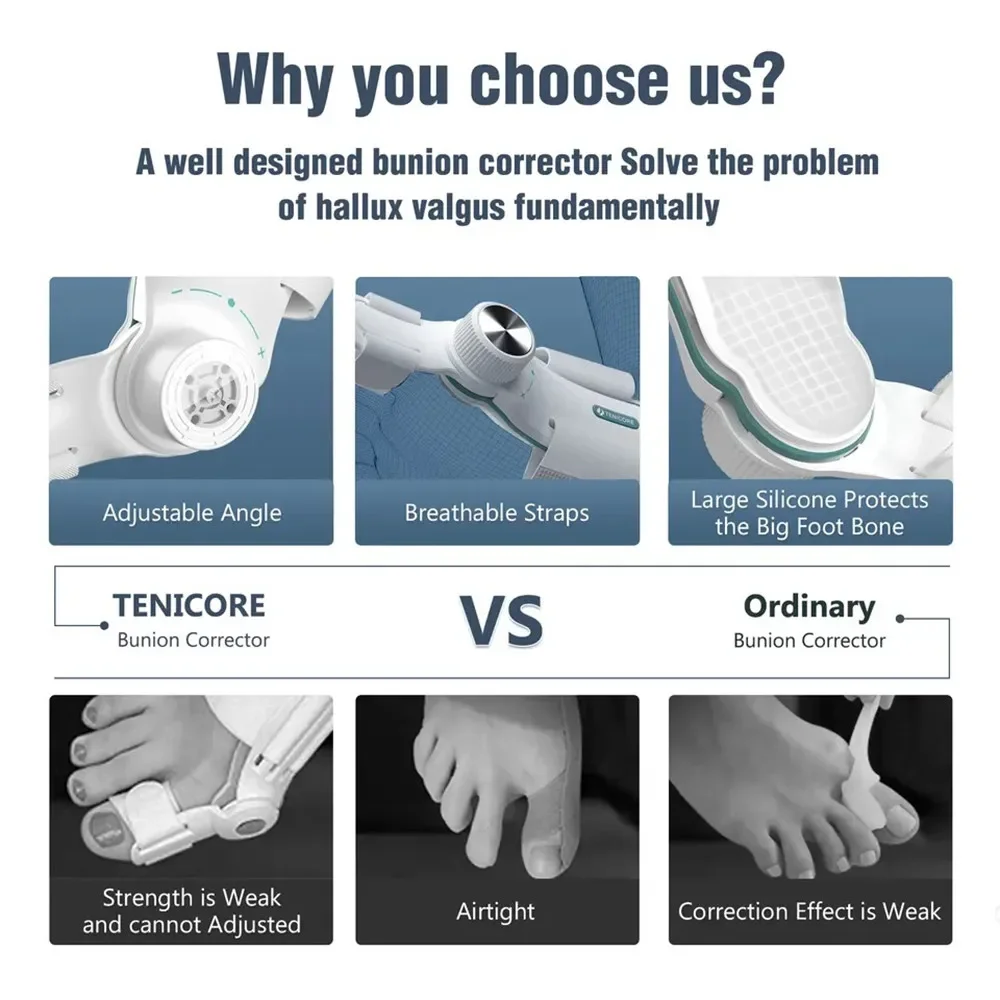 Bunion Corrector Hallux Valgus Orthotics Big Toe Homing Straightener Adjustable Knobs With 3 Angle Fixing Plate Foot Bunion Corrector Hallux Valgus Orthotics Big Toe Homing Straightener Adjustable Knobs With 3 Angle Fixing Plate Foot