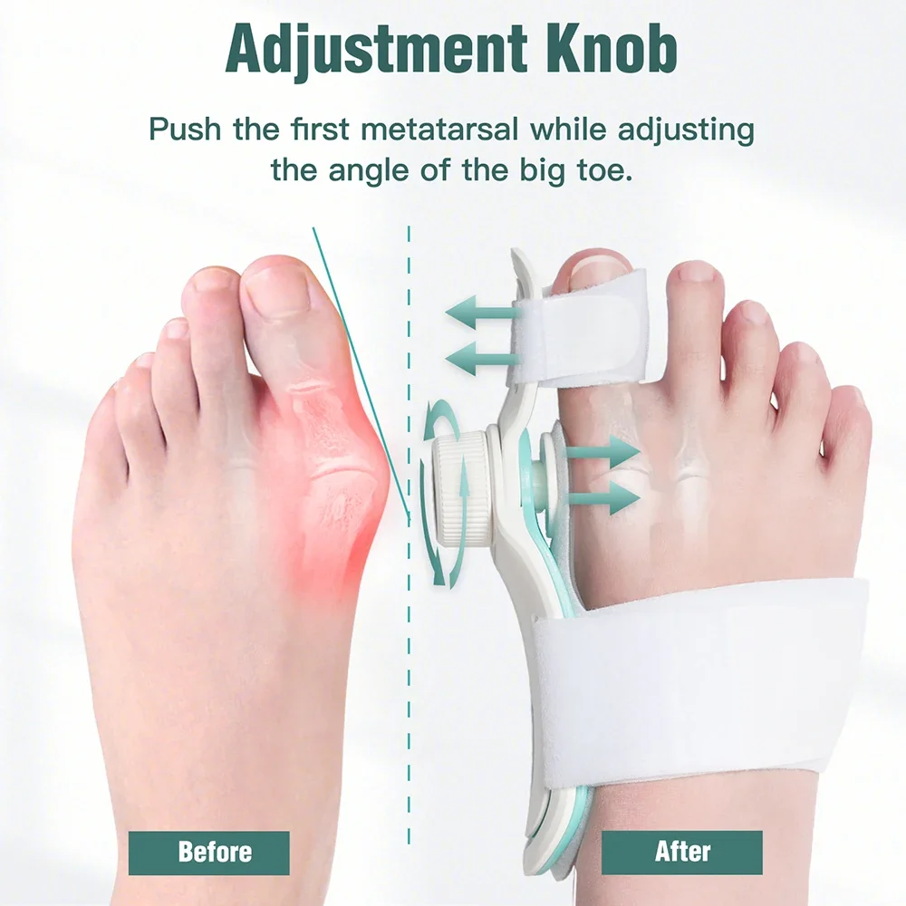 Bunion Corrector Hallux Valgus Orthotics Big Toe Homing Straightener Adjustable Knobs With 3 Angle Fixing Plate Foot Bunion Corrector Hallux Valgus Orthotics Big Toe Homing Straightener Adjustable Knobs With 3 Angle Fixing Plate Foot