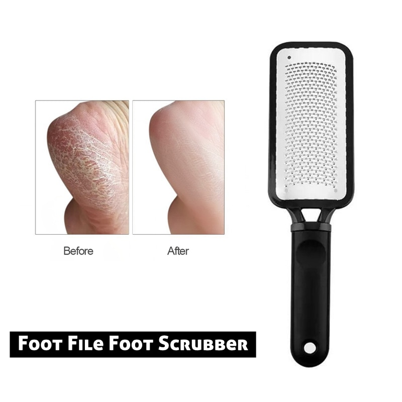 Callus File Dead Skin Remover