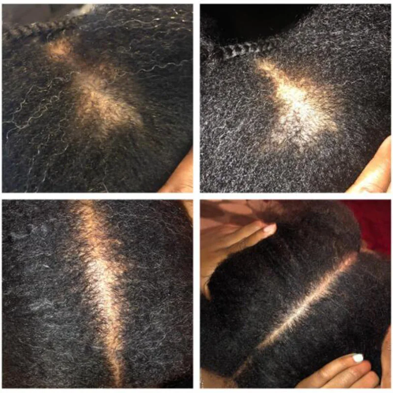 Chebe Powder Extraction Oil Soften and Smooth Stop Breakage for Hair Growth Chebe Powder Extraction Oil Soften and Smooth Stop Breakage for Hair Growth