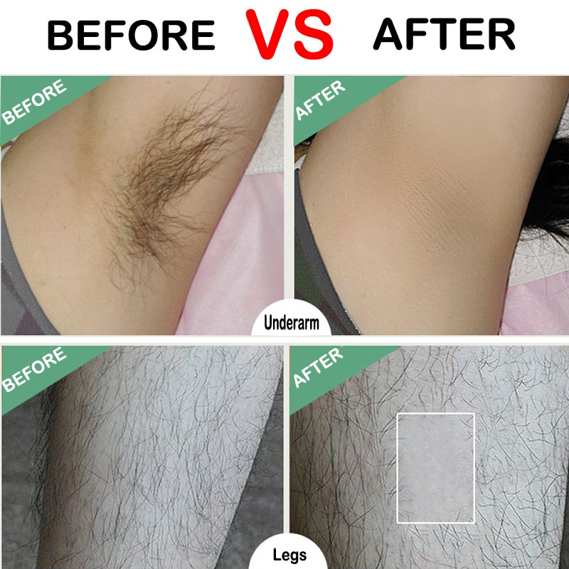 Cold Wax Strips Hair Removal Paper Cold Wax Strips Hair Removal Paper