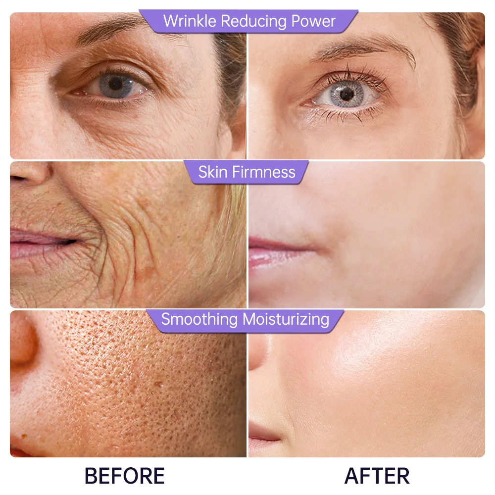 Collagen Face Serum Wrinkle Removal Anti Aging Skin Care Hyaluronic Acid Forehead Fine Lines Lifting Repair Facial Serum Collagen Face Serum Wrinkle Removal Anti Aging Skin Care Hyaluronic Acid Forehead Fine Lines Lifting Repair Facial Serum