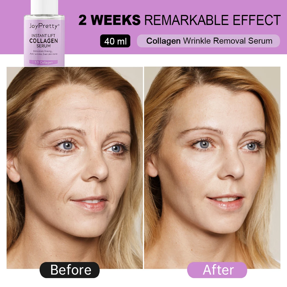 Collagen Face Serum Wrinkle Removal Anti Aging Skin Care Hyaluronic Acid Forehead Fine Lines Lifting Repair Facial Serum Collagen Face Serum Wrinkle Removal Anti Aging Skin Care Hyaluronic Acid Forehead Fine Lines Lifting Repair Facial Serum
