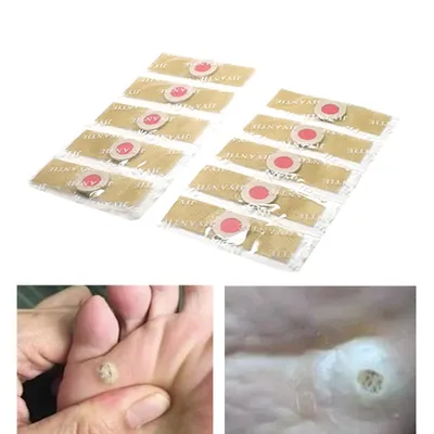 Corn Patches for Feet Medical Plaster (60 pcs) Corn Patches for Feet Medical Plaster (60 pcs)