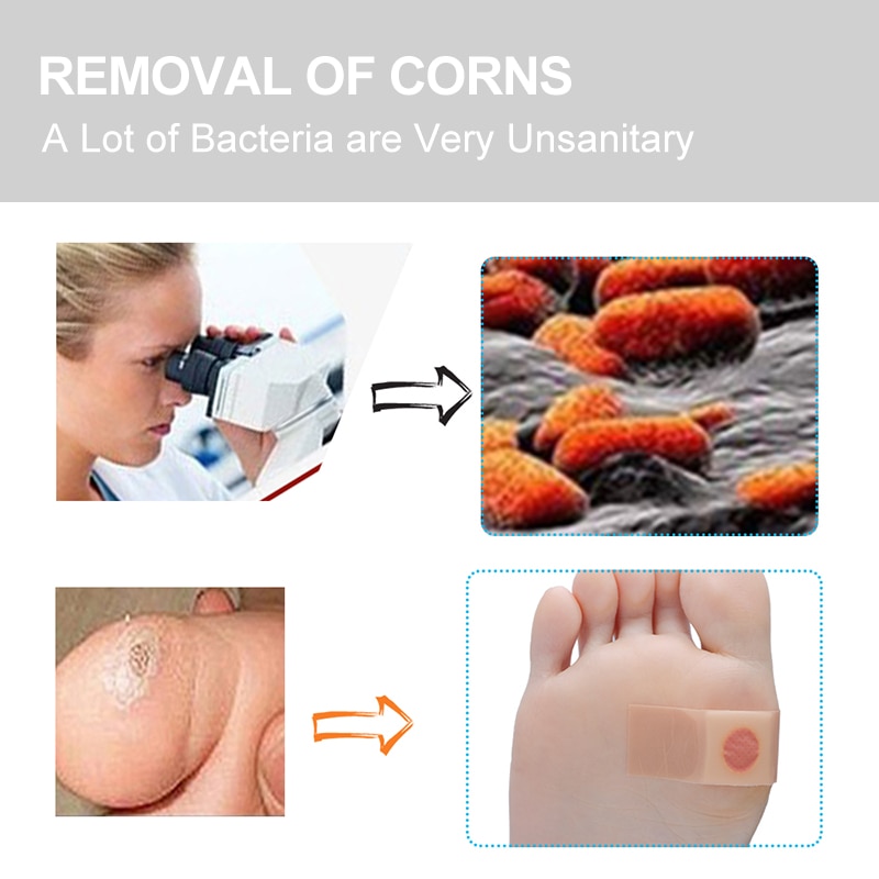 Corn Patches for Feet Medical Plaster (60 pcs) Corn Patches for Feet Medical Plaster (60 pcs)
