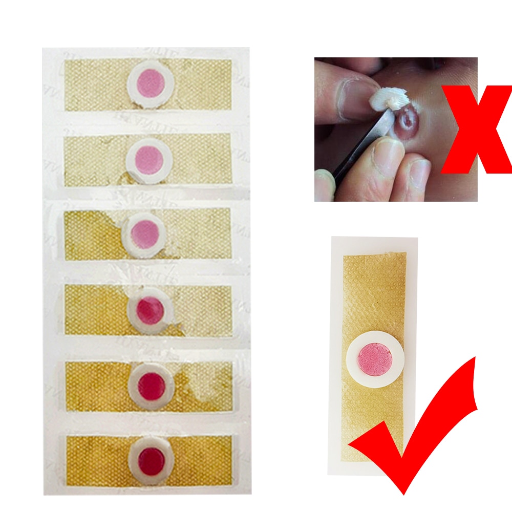 Corn Removal Pads Foot Corn Remover (18 pcs) Corn Removal Pads Foot Corn Remover (18 pcs)