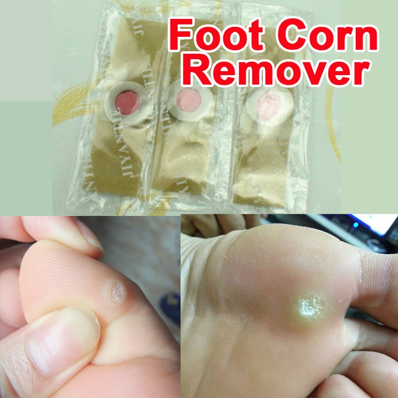 Corn Removal Plaster 24-Patch Pack Corn Removal Plaster 24-Patch Pack