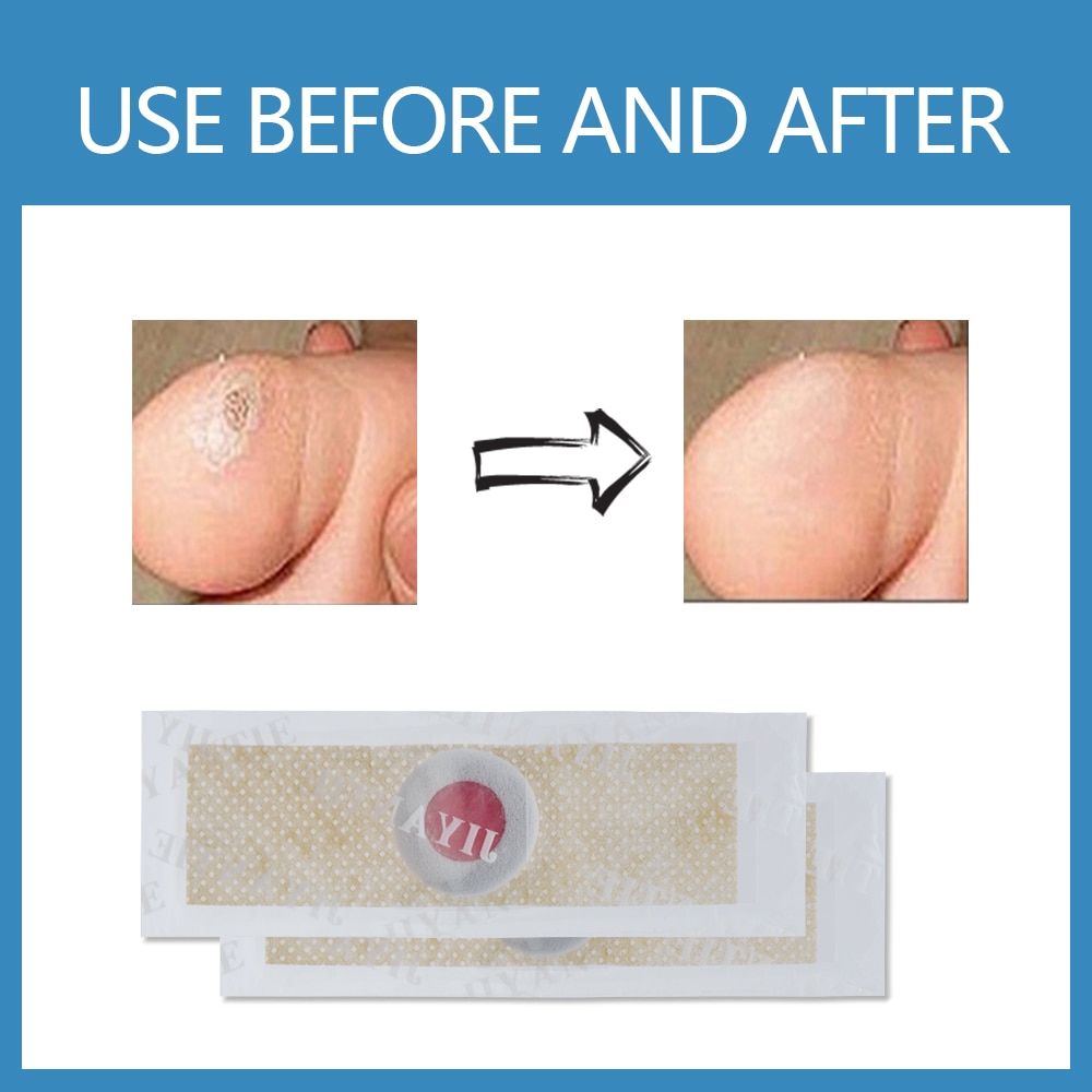Corn Removal Plaster 24-Patch Pack Corn Removal Plaster 24-Patch Pack