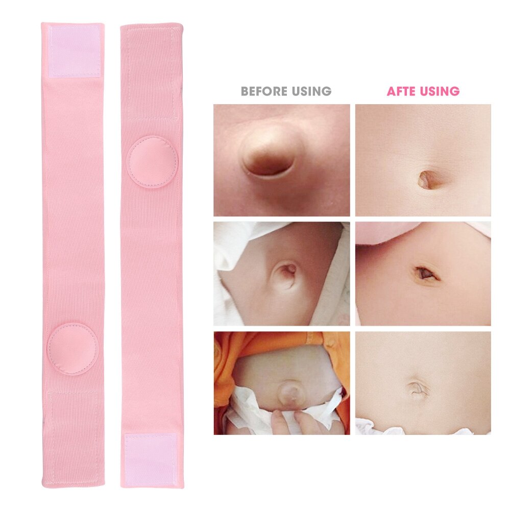 Cotton Infant Umbilical Hernia Belts (2pcs) Cotton Infant Umbilical Hernia Belts (2pcs)
