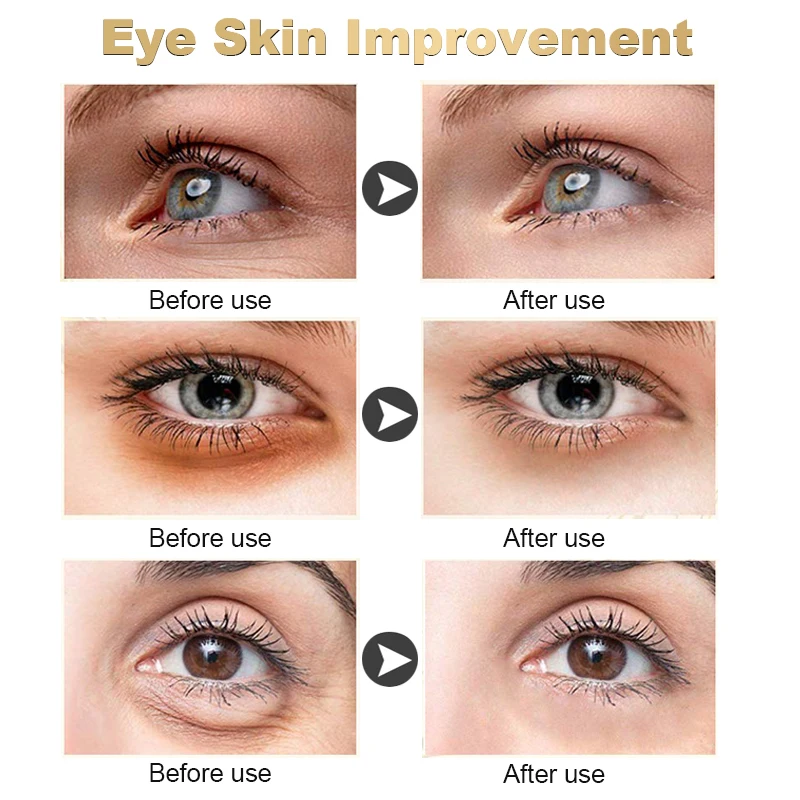 Dark Circle Remover Eye Cream Peptide Anti Wrinkle Removal Eye Bags Puffiness Fade Fine Lines Whitening Lightening Eye