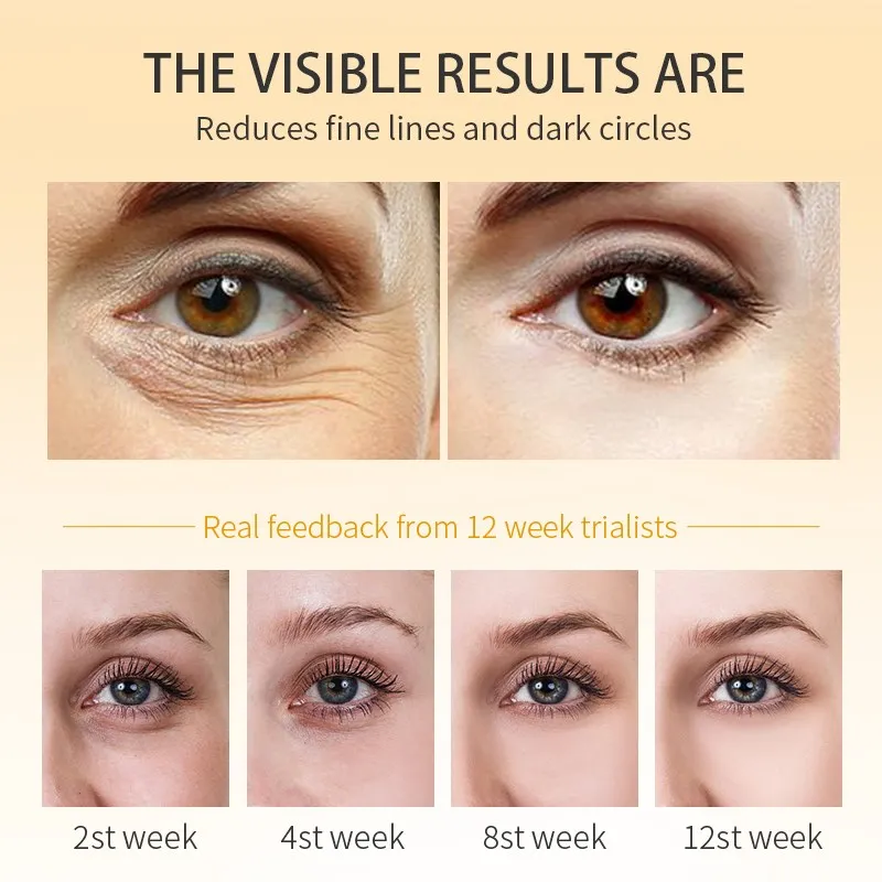 Dark Circle Remover Eye Cream Peptide Anti Wrinkle Removal Eye Bags Puffiness Fade Fine Lines Whitening Lightening Eye