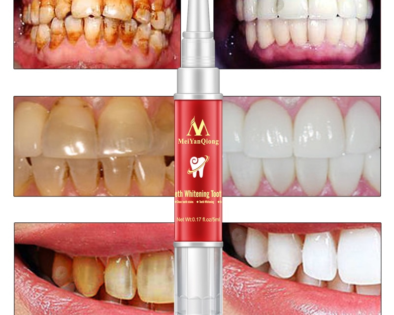 Dental Tool Best Toothbrush Dental Tool Best Toothbrush