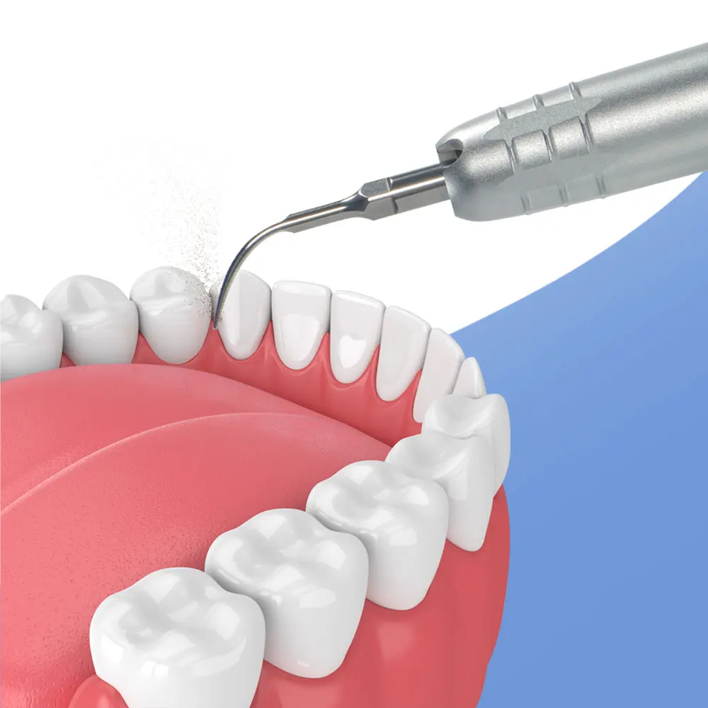 Dental Ultrasonic Air Scaler with 3 Tips Tooth Calculus Remover Cleaning tool Handpiece Whiten Tooth Cleaner