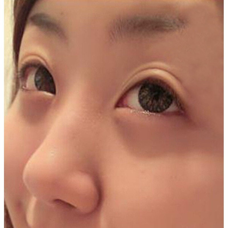 Double Eyelid Tape For Monolids (480 Pcs) Double Eyelid Tape For Monolids (480 Pcs)