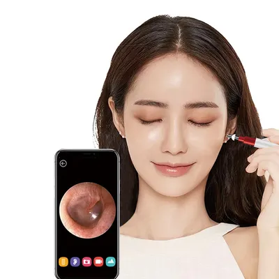 Ear Cleaning Tools HD WiFi Otoscope Ear Cleaning Tools HD WiFi Otoscope