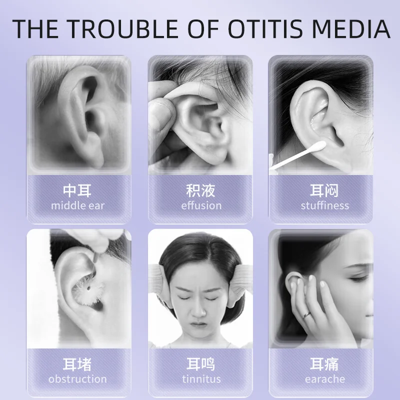Ear Pressure Reliever, Eustachian Tube Unblocker, Balancing Ear Pressure to Relieve Tinnitus and Earache