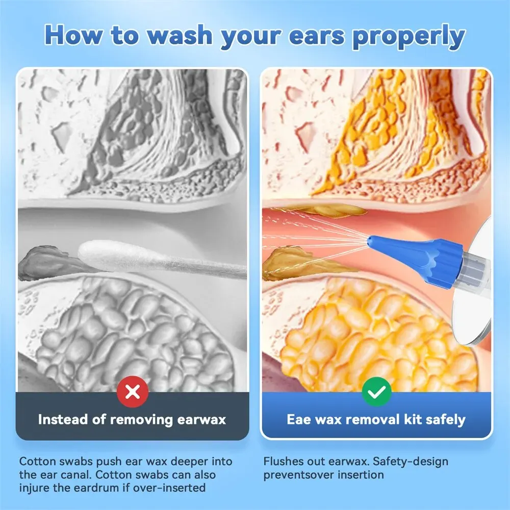 Ear Wax Removal Manual Ear Cleaner Water Cleaner Earwax Remover Kit Ear Irrigation Flushing System Ear Cleaning Kit