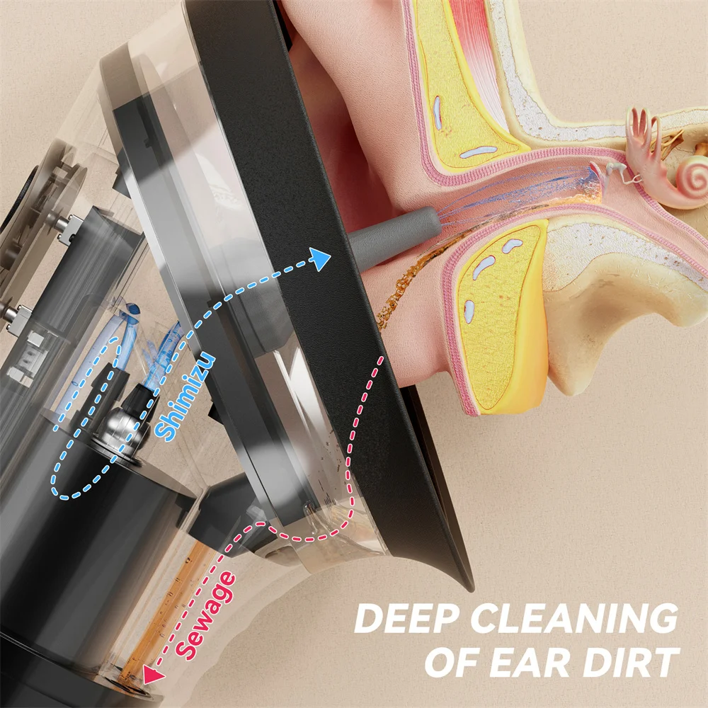 Electric Ear Wax Removal System Water Powered Ear Cleaning Tool with Irrigation Flusher 3 Pressure Settings Safe