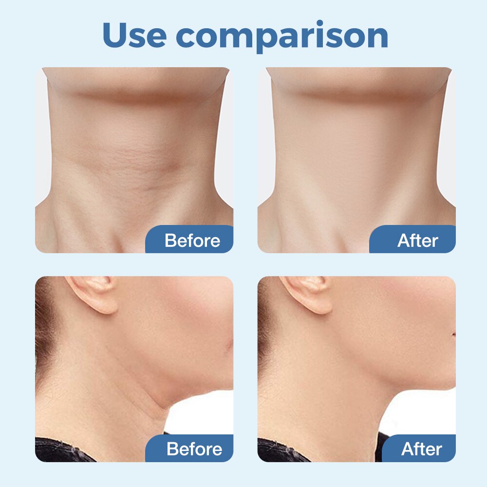 Electric Neck Beauty Massager EMS Color Light Neck Beauty Equipment Face and Neck Massage Neck Wrinkles USB Charging Electric Neck Beauty Massager EMS Color Light Neck Beauty Equipment Face and Neck Massage Neck Wrinkles USB Charging