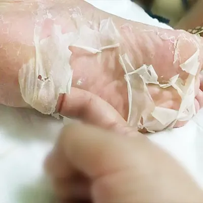 Exfoliating Foot Peel Mask Exfoliating Foot Peel Mask