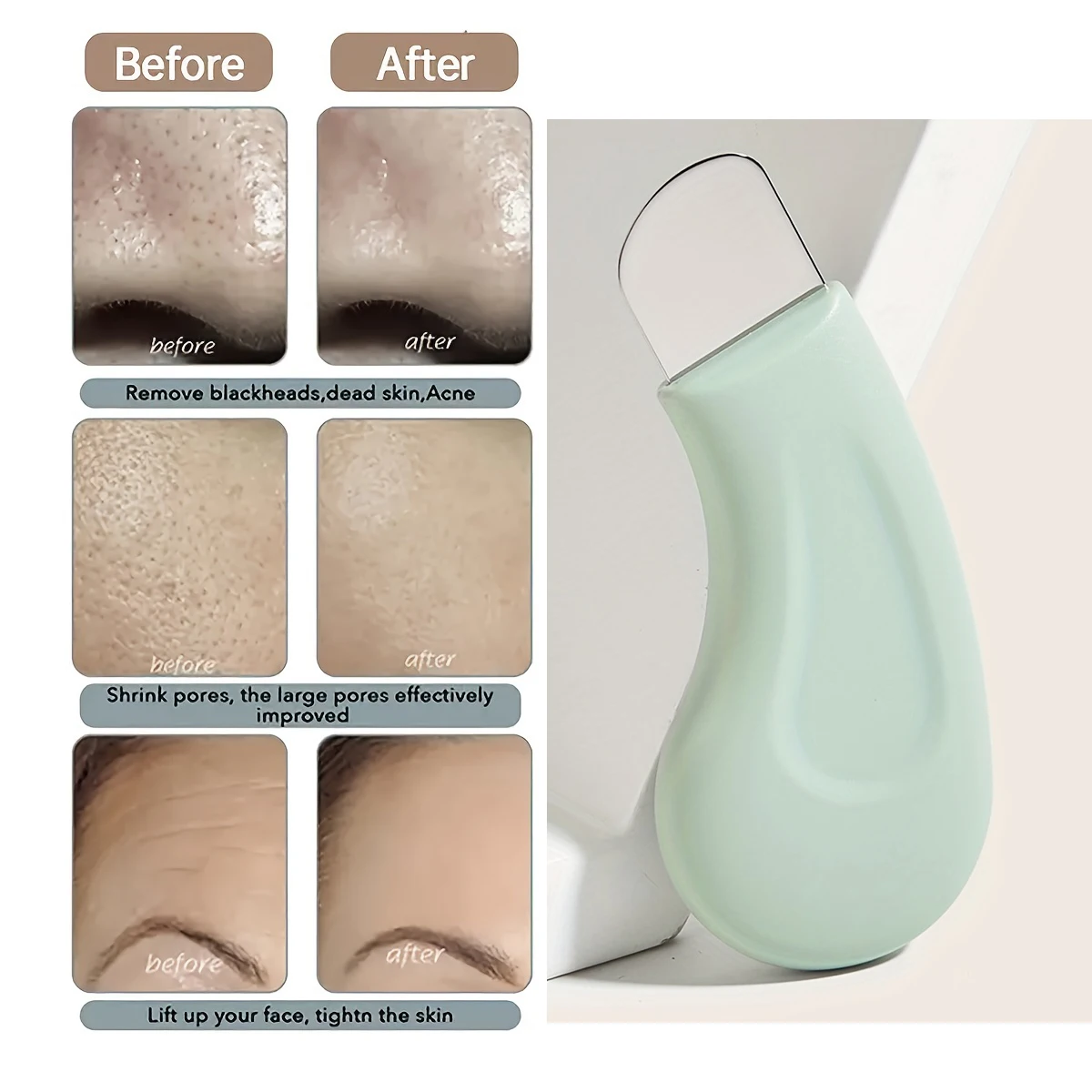 Facial Blackhead Removal Tool Nose Deep Cleansing Remove Whitehead Acne Handheld Beauty Care Tool Facial Blackhead Removal Tool Nose Deep Cleansing Remove Whitehead Acne Handheld Beauty Care Tool