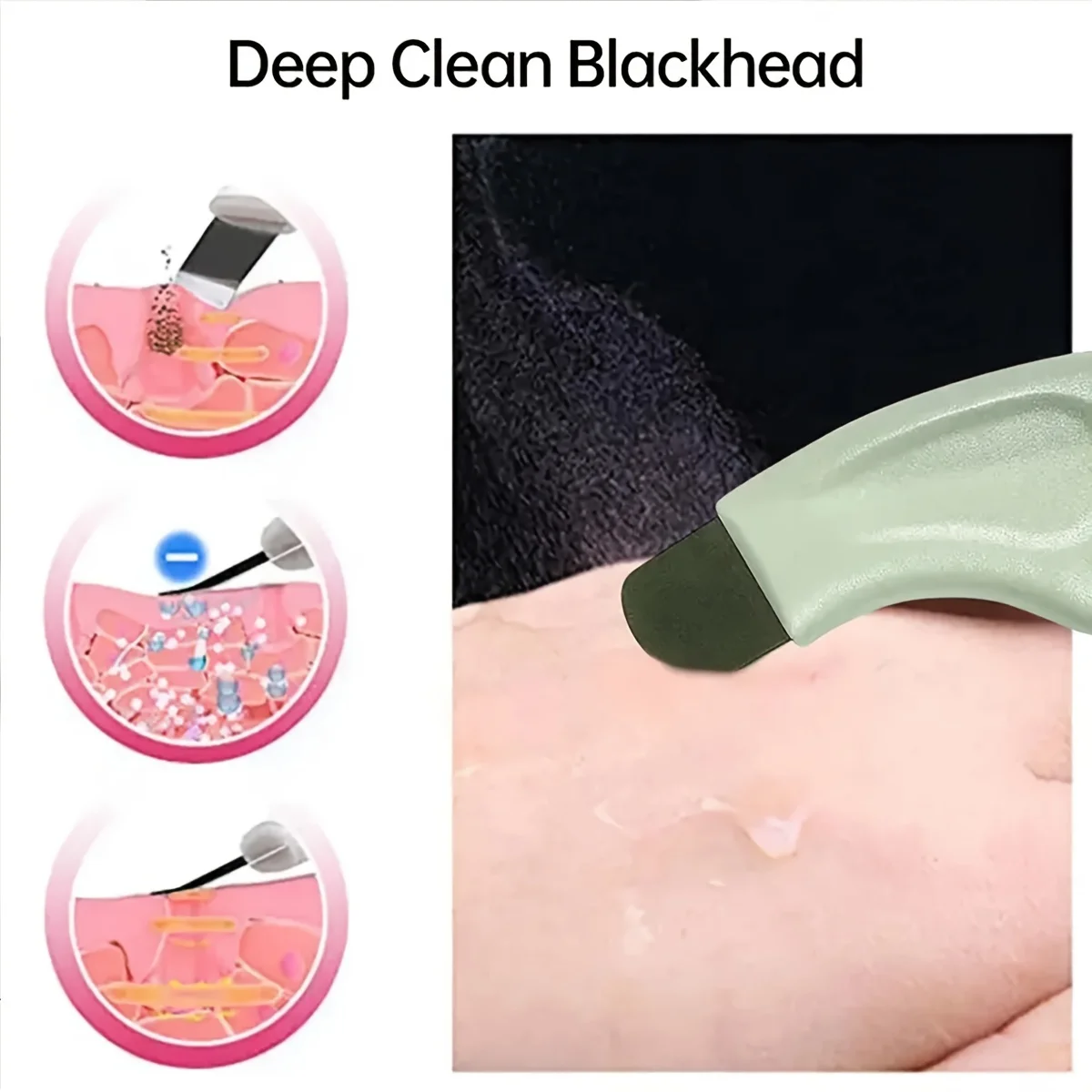 Facial Blackhead Removal Tool Nose Deep Cleansing Remove Whitehead Acne Handheld Beauty Care Tool Facial Blackhead Removal Tool Nose Deep Cleansing Remove Whitehead Acne Handheld Beauty Care Tool