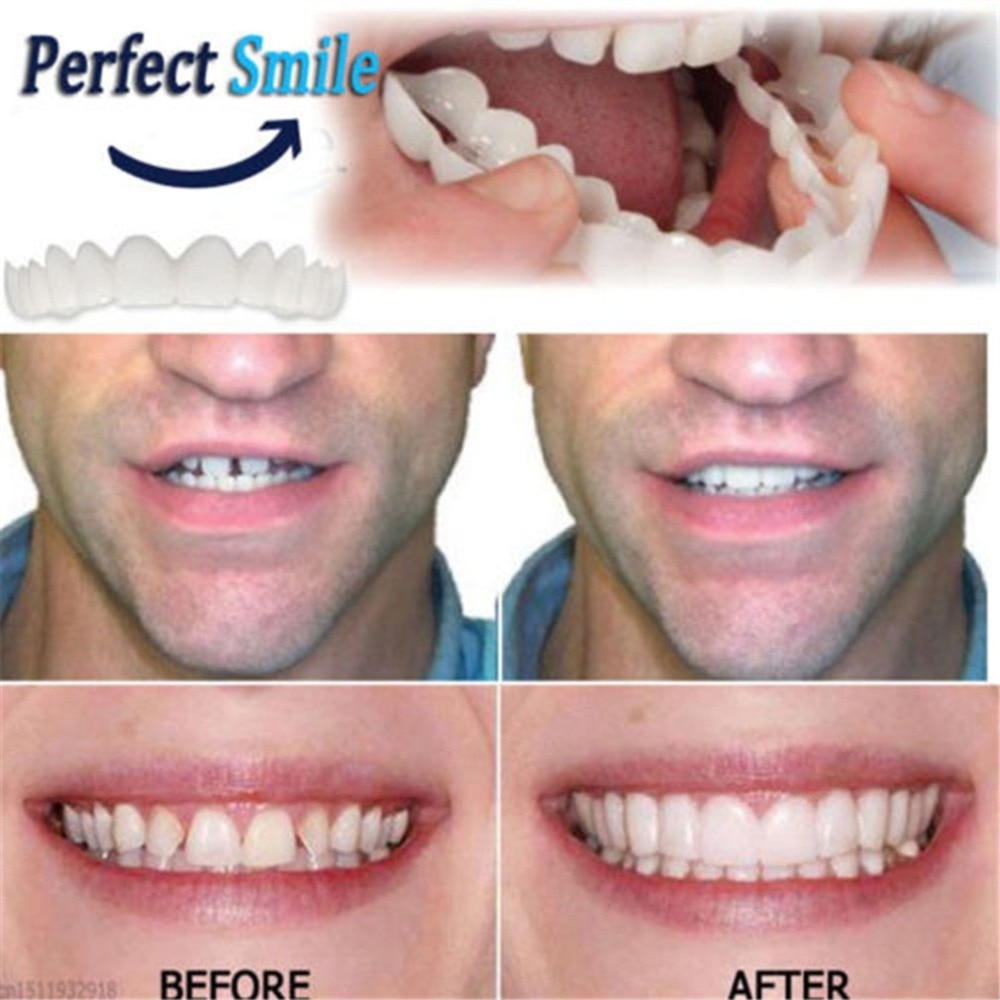 Fake Teeth Instant Perfect Smile Fake Teeth Instant Perfect Smile