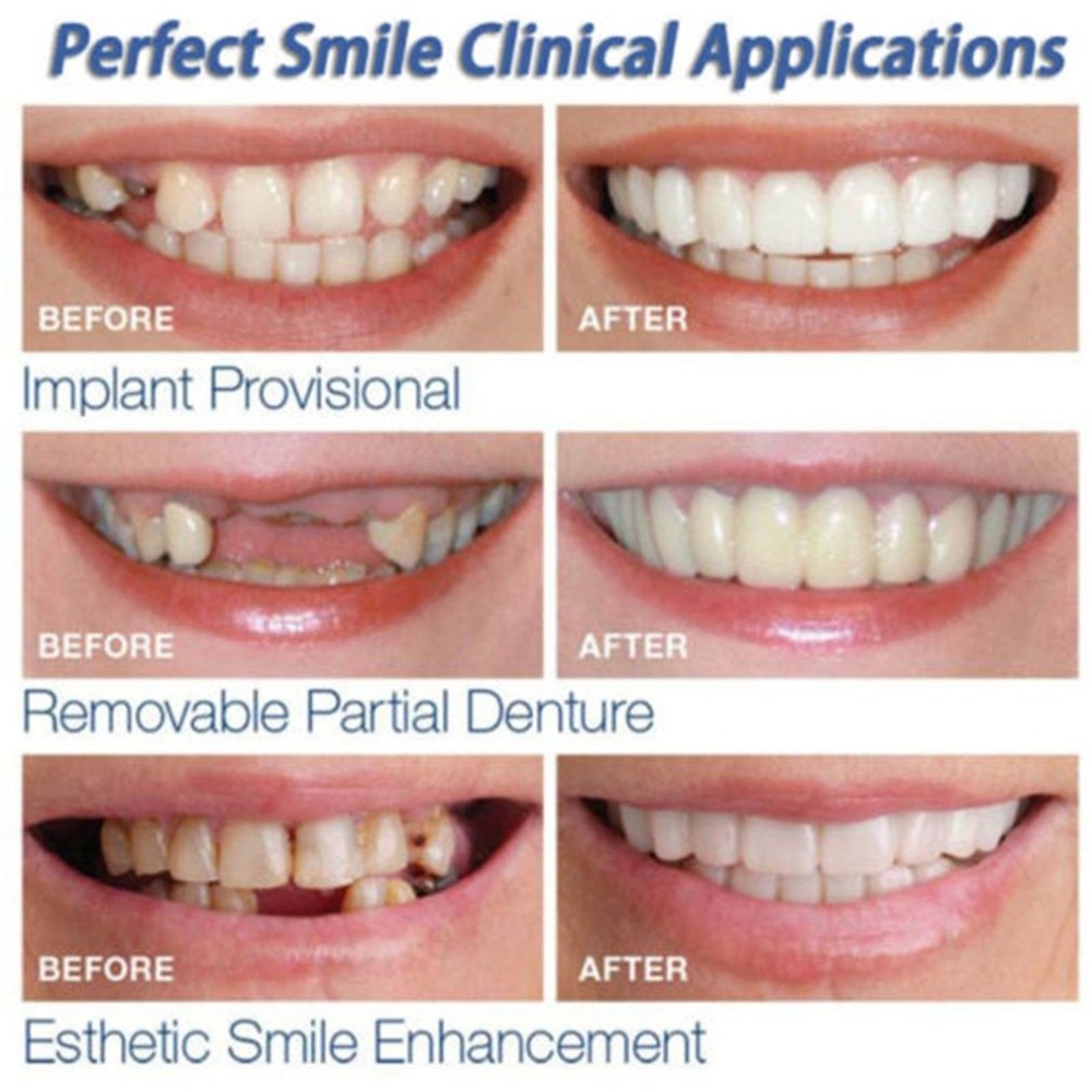 Fake Teeth Instant Perfect Smile Fake Teeth Instant Perfect Smile