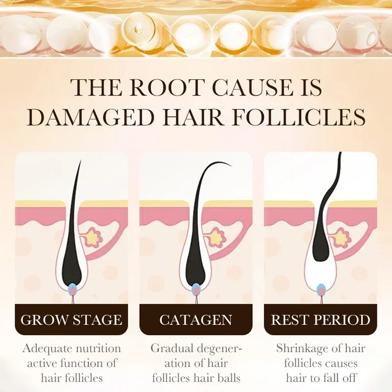 Fast Hair Growth Essence Effective Anti Hair Loss Serum Baldness Repair Hereditary Postpartum Seborrheic Hair Loss oil Fast Hair Growth Essence Effective Anti Hair Loss Serum Baldness Repair Hereditary Postpartum Seborrheic Hair Loss oil