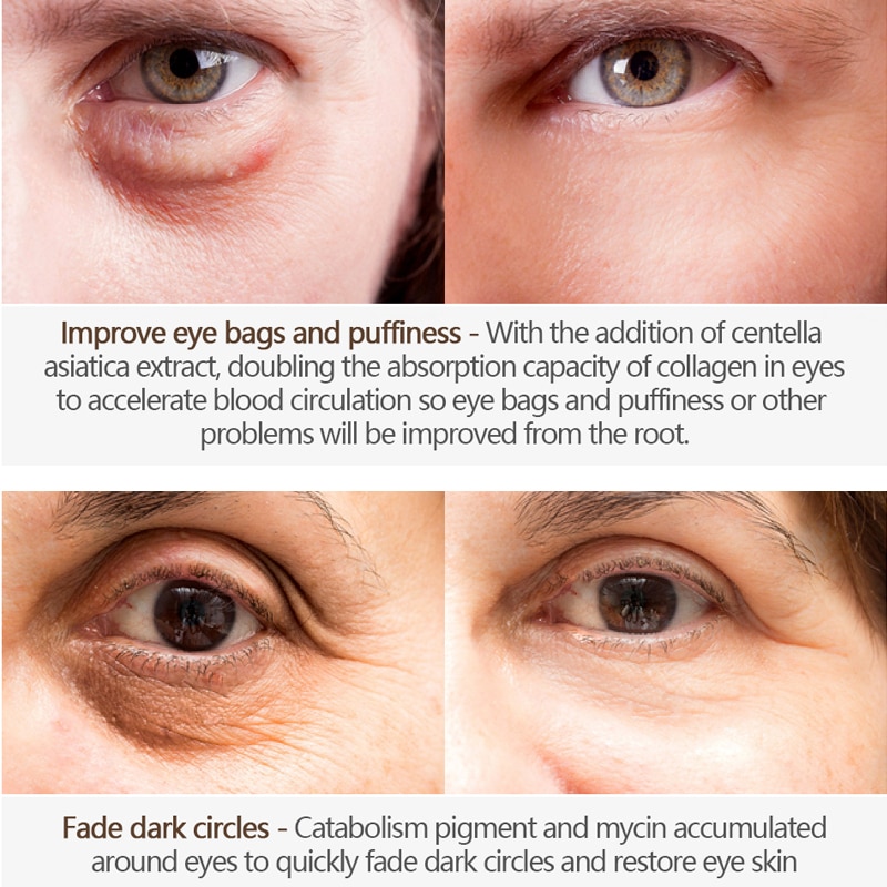 Firming Eye Cream Wrinkle Treatment Firming Eye Cream Wrinkle Treatment