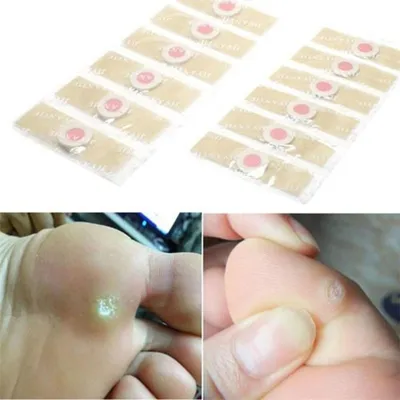 Foot Corn Removal Feet Patches Foot Corn Removal Feet Patches