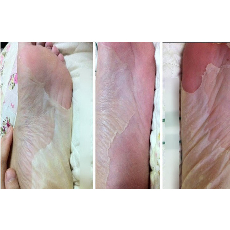 Foot Peel Mask Foot Care (Set of 6) Foot Peel Mask Foot Care (Set of 6)