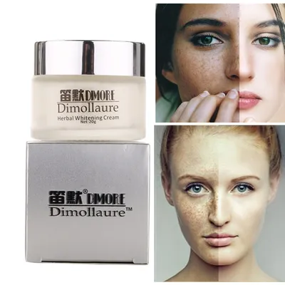 Freckle Removal Face Cream Freckle Removal Face Cream
