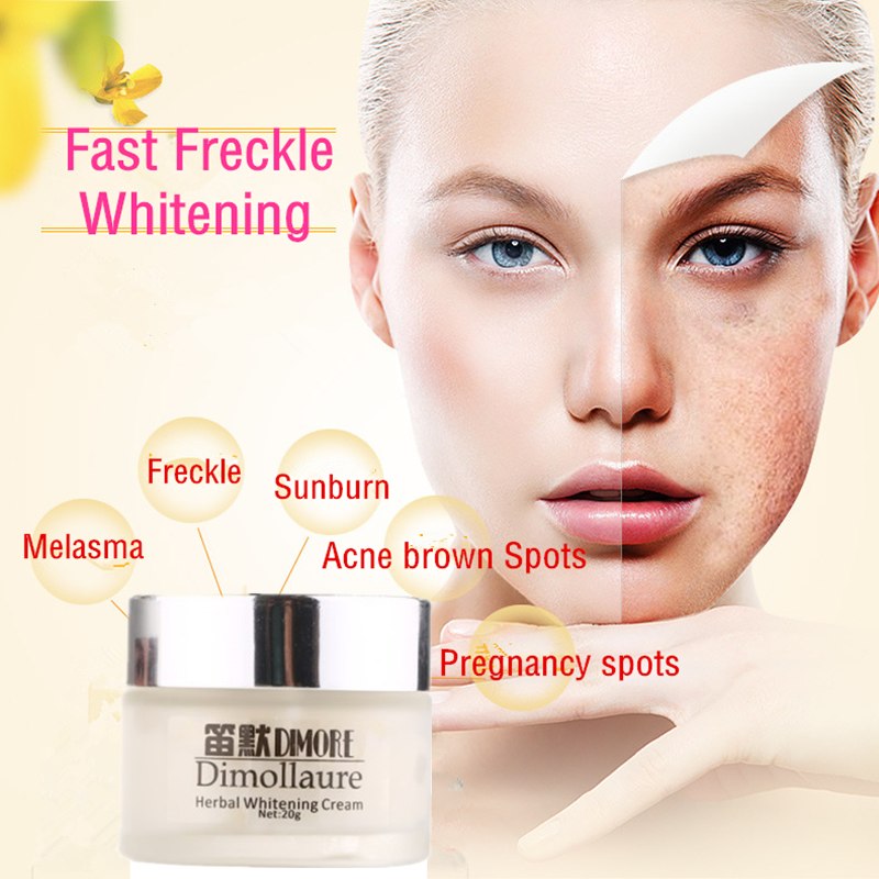 Freckle Removal Face Cream Freckle Removal Face Cream