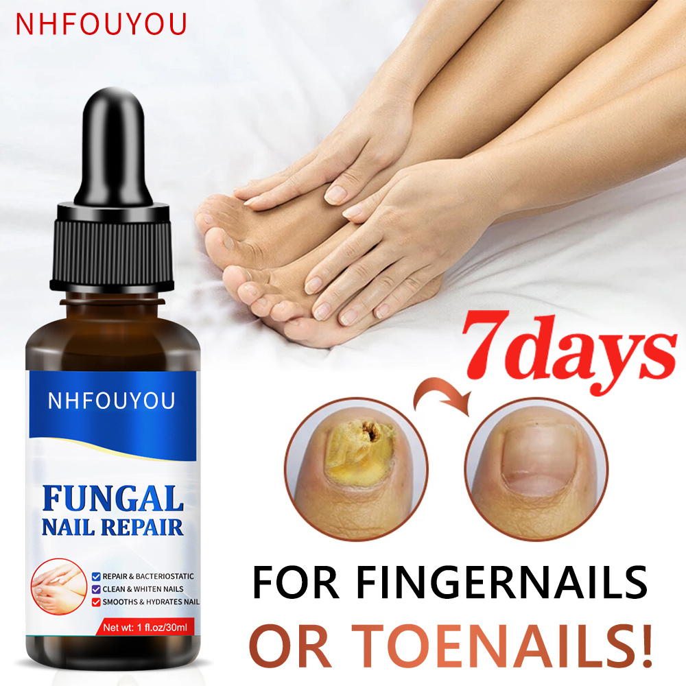 Fungal Nail Treatment Oil Foot Repair Essence Toe Nail Fungus Removal Gel Anti Infection Cream Fungal Nail Removal 10ML Fungal Nail Treatment Oil Foot Repair Essence Toe Nail Fungus Removal Gel Anti Infection Cream Fungal Nail Removal 10ML