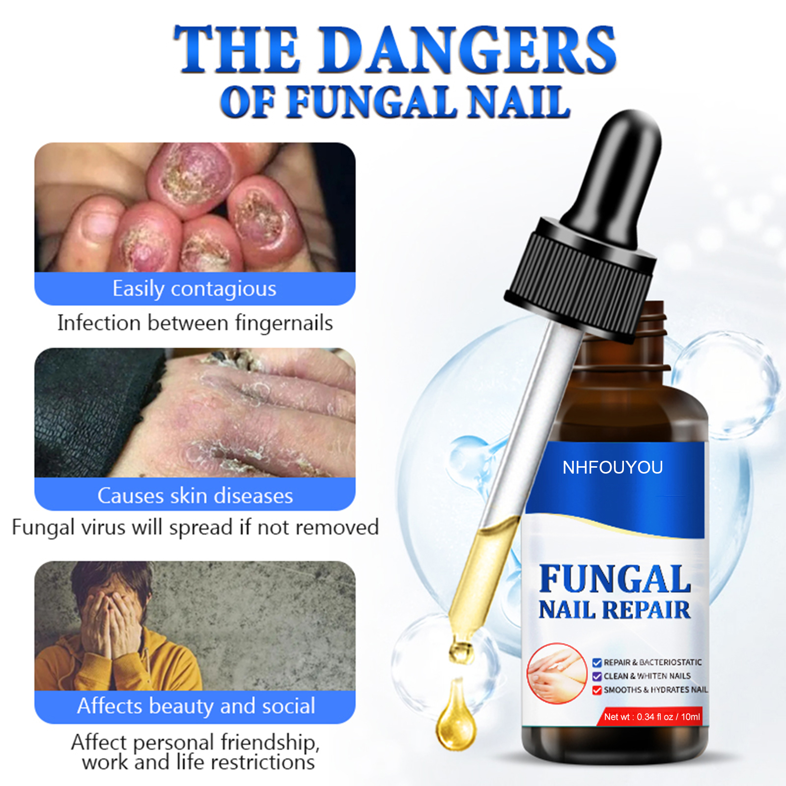 Fungal Nail Treatment Oil Foot Repair Essence Toe Nail Fungus Removal Gel Anti Infection Cream Fungal Nail Removal 10ML Fungal Nail Treatment Oil Foot Repair Essence Toe Nail Fungus Removal Gel Anti Infection Cream Fungal Nail Removal 10ML