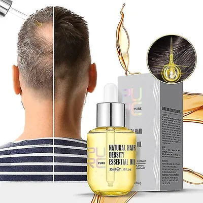 Ginger Hair Growth Products Prevent Hair Loss Essential Oil Fast Growing Scalp Treatment Beauty Health for Men Women Ginger Hair Growth Products Prevent Hair Loss Essential Oil Fast Growing Scalp Treatment Beauty Health for Men Women
