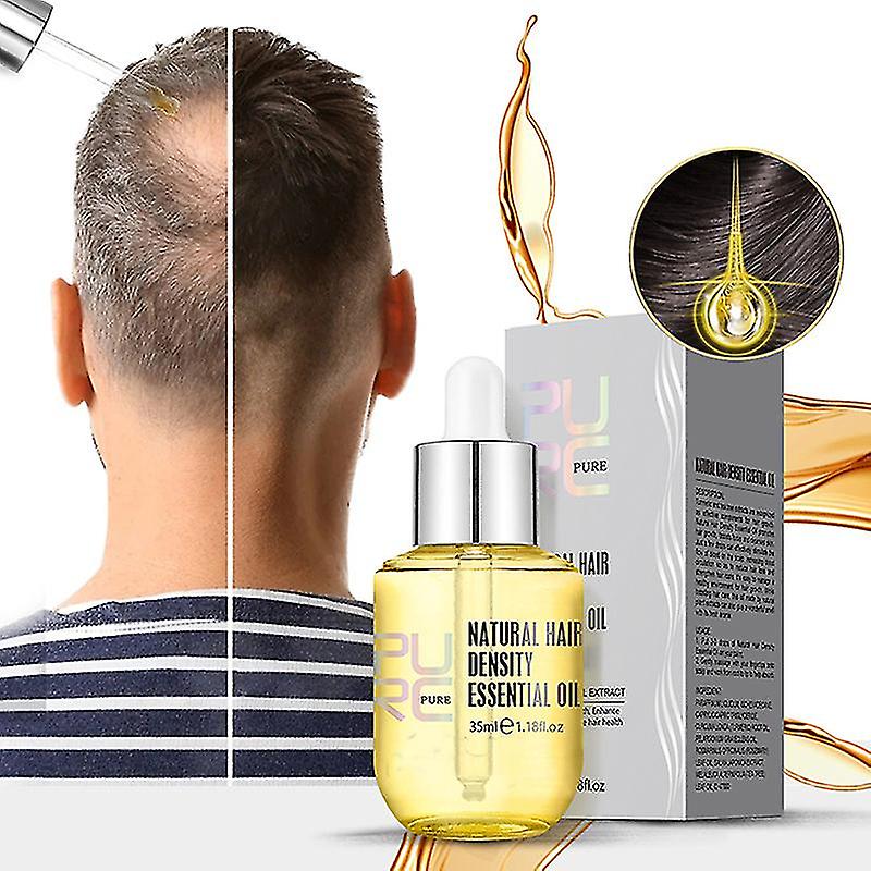 Ginger Hair Growth Products Prevent Hair Loss Essential Oil Fast Growing Scalp Treatment Beauty Health for Men Women