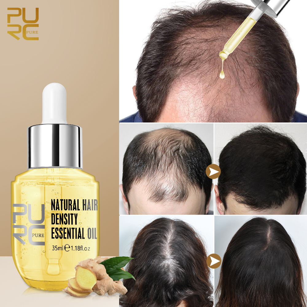 Ginger Hair Growth Products Prevent Hair Loss Essential Oil Fast Growing Scalp Treatment Beauty Health for Men Women Ginger Hair Growth Products Prevent Hair Loss Essential Oil Fast Growing Scalp Treatment Beauty Health for Men Women