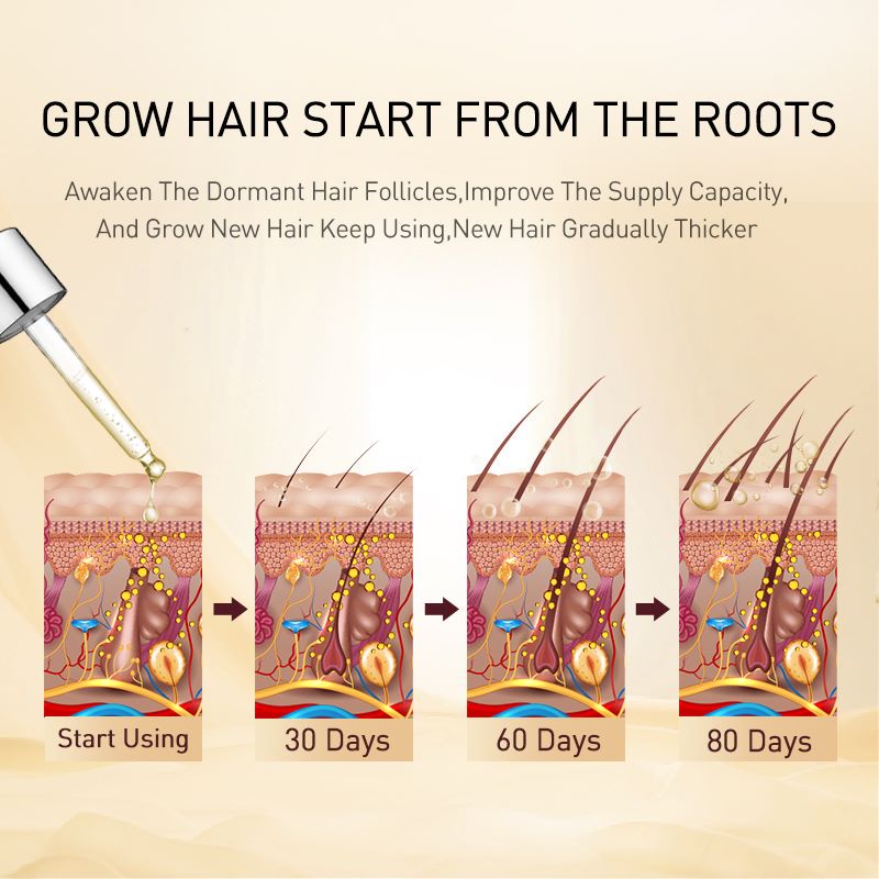 Ginger Hair Growth Products Prevent Hair Loss Essential Oil Fast Growing Scalp Treatment Beauty Health for Men Women Ginger Hair Growth Products Prevent Hair Loss Essential Oil Fast Growing Scalp Treatment Beauty Health for Men Women