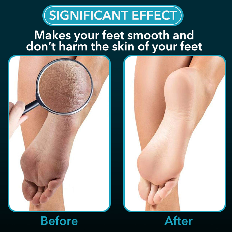Glass Foot File Dead Skin Remover (2 pcs)