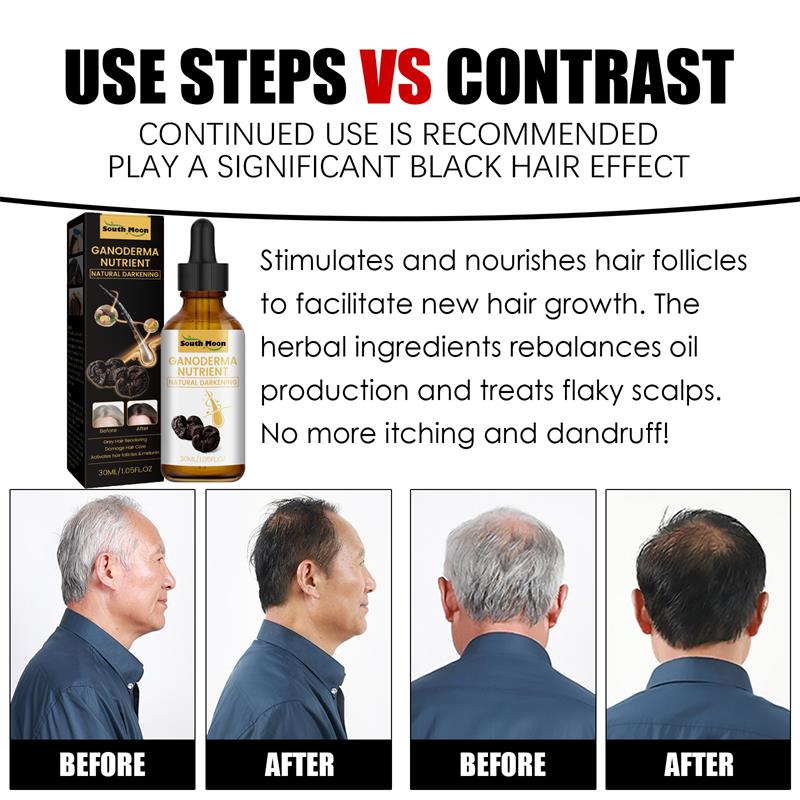 Gray White Hair Treatment Serum Liquid White To Black Natural Color Repair Nourish Product Anti Loss Hair Care Men Women