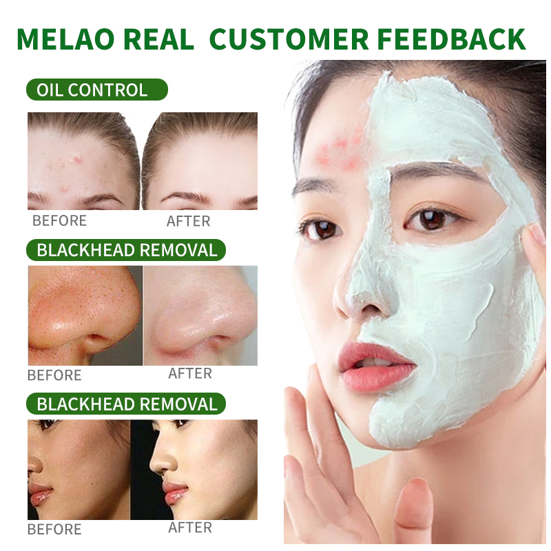 Green Tea Blackhead Remover Stick