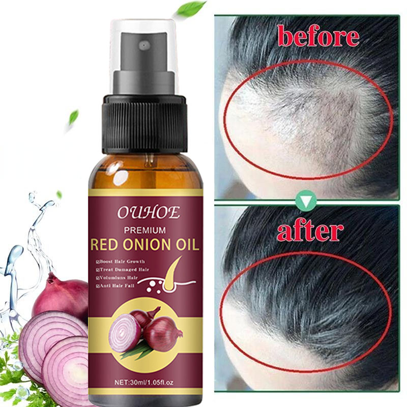 Growth Enhancer Onion Hair Serum Growth Enhancer Onion Hair Serum