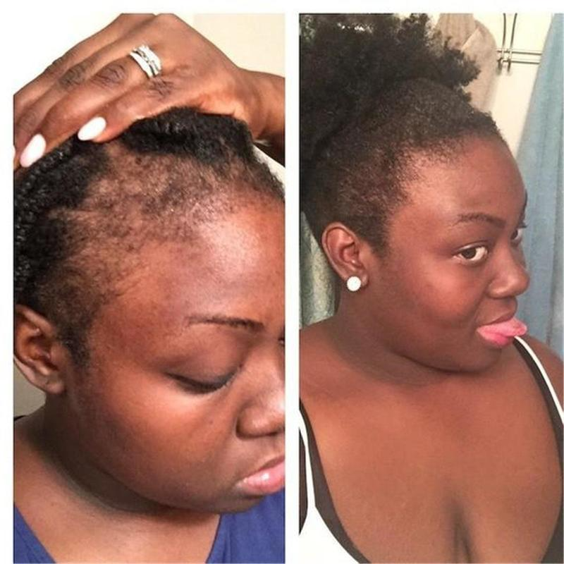 Growth Enhancer Onion Hair Serum Growth Enhancer Onion Hair Serum
