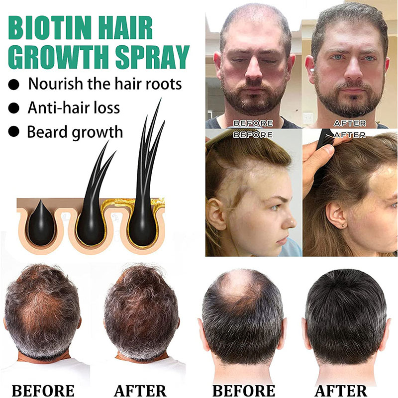 Growth Enhancer Onion Hair Serum Growth Enhancer Onion Hair Serum