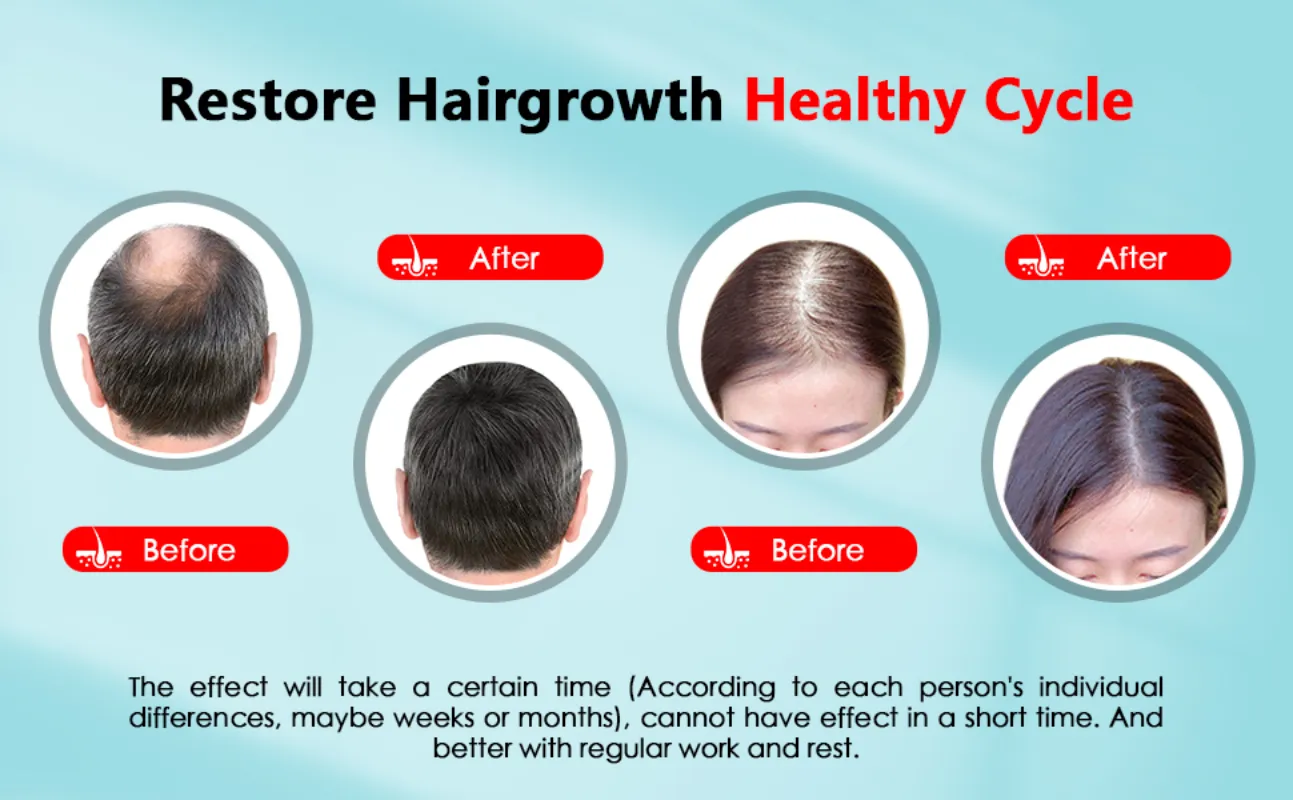 Hair Growth Cap Anti Hair Loss Head Massage Stress Relief Electric Scalp Massager Infrared Light Relaxation Therapy Led